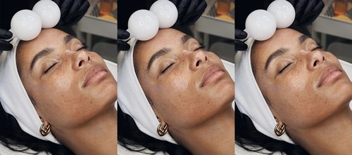 7 Cryotherapy Tools For Fresher-Looking Skin